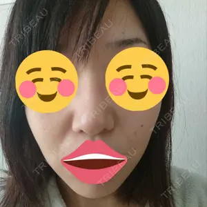 リッツ美容外科 大阪院口コミ