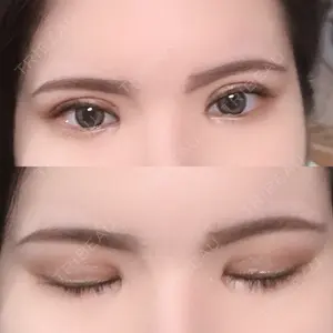 東京BELLEZZAクリニック口コミ