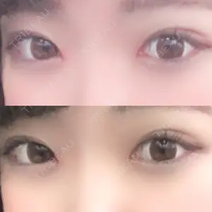 口コミ