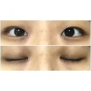 東京BELLEZZAクリニック口コミ