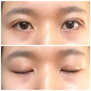 湘南美容クリニック 湘南美容クリニック 赤坂見附院口コミ