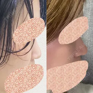 リッツ美容外科 大阪院口コミ