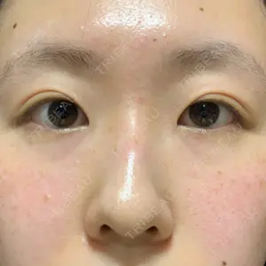 湘南美容クリニック 湘南美容クリニック 千葉センシティ院口コミ