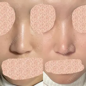 リッツ美容外科 大阪院口コミ