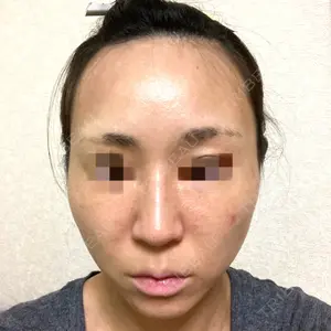 湘南美容クリニック 湘南美容クリニック 千葉センシティ院口コミ