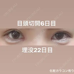 口コミ