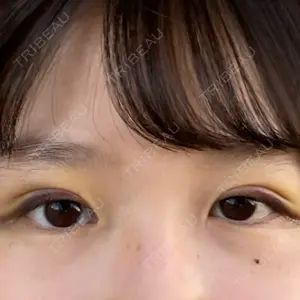 口コミ