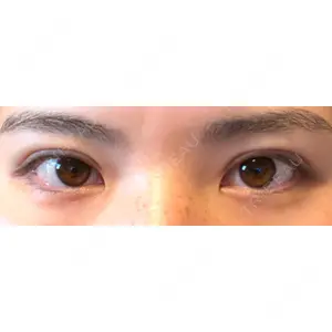 TCB東京中央美容外科 TCB東京中央美容外科 町田院口コミ