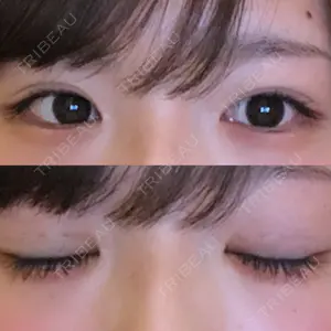R.O.clinic口コミ