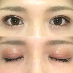 口コミ