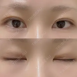 湘南美容クリニック 湘南美容クリニック 金山院口コミ