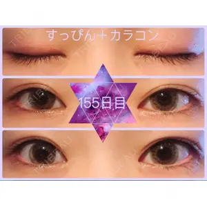 口コミ