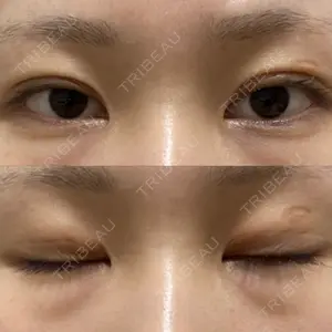 湘南美容クリニック 湘南美容クリニック 金山院口コミ