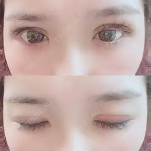 口コミ