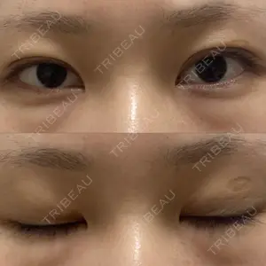 湘南美容クリニック 湘南美容クリニック 金山院口コミ