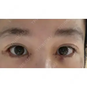 TCB東京中央美容外科 TCB東京中央美容外科 渋谷東口院口コミ