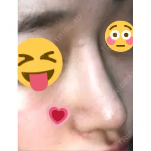 HANABI整形外科口コミ