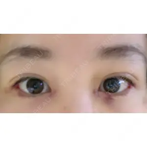 TCB東京中央美容外科 TCB東京中央美容外科 渋谷東口院口コミ