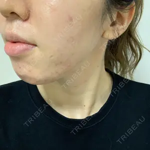 アサイクリニック 心斎橋本院口コミ