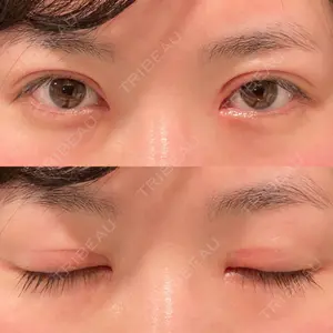 口コミ