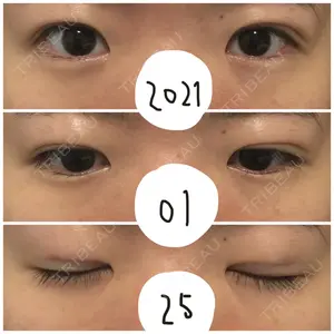 東京イセアクリニック口コミ