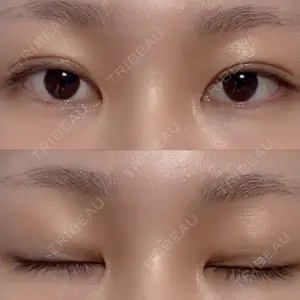 湘南美容クリニック 湘南美容クリニック 金山院口コミ