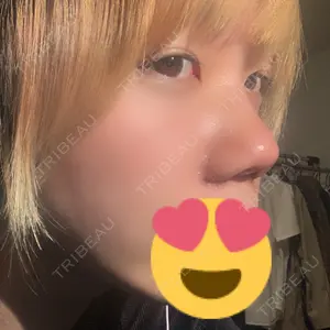 TCB東京中央美容外科 TCB東京中央美容外科 渋谷東口院口コミ