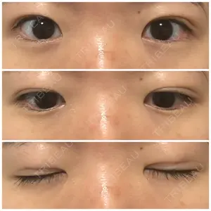 東京イセアクリニック口コミ