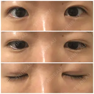 東京イセアクリニック口コミ