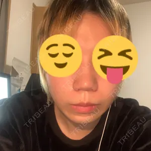 TCB東京中央美容外科 TCB東京中央美容外科 渋谷東口院口コミ