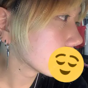 TCB東京中央美容外科 TCB東京中央美容外科 渋谷東口院口コミ