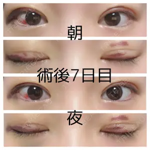 湘南美容クリニック 湘南美容クリニック 松山院口コミ