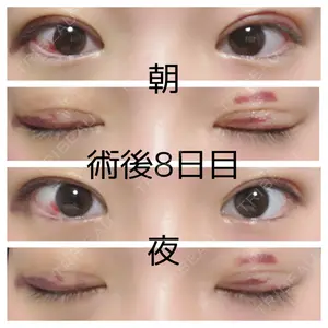 湘南美容クリニック 湘南美容クリニック 松山院口コミ