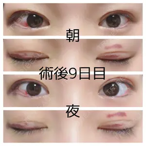 湘南美容クリニック 湘南美容クリニック 松山院口コミ
