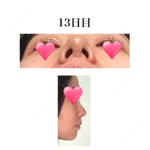 口コミ