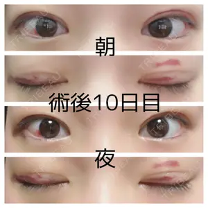 湘南美容クリニック 湘南美容クリニック 松山院口コミ