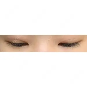 湘南美容クリニック 湘南美容クリニック 宇都宮院口コミ