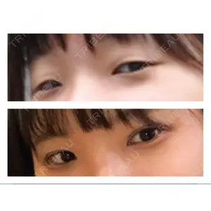 口コミ