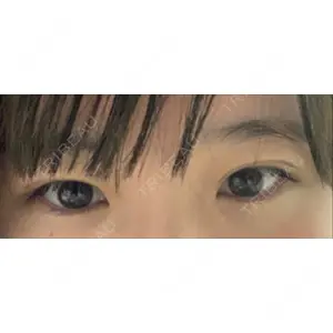 TCB東京中央美容外科 TCB東京中央美容外科 新宿三丁目院口コミ