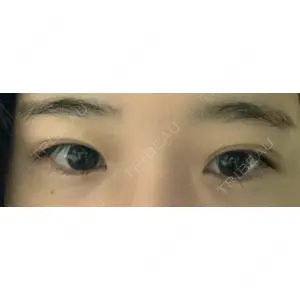 TCB東京中央美容外科 TCB東京中央美容外科 新宿三丁目院口コミ