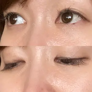 口コミ
