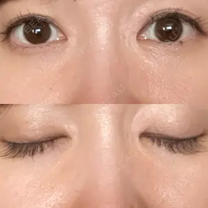 口コミ