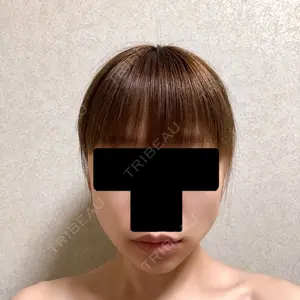 湘南美容クリニック 湘南美容クリニック 金山院口コミ