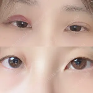 湘南美容クリニック 湘南美容クリニック 宇都宮院口コミ