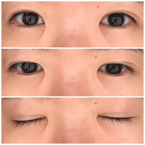 東京イセアクリニック口コミ