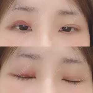 湘南美容クリニック 湘南美容クリニック 宇都宮院口コミ