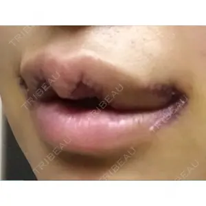 現代美学整形外科口コミ