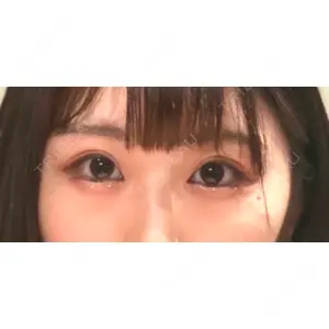 口コミ