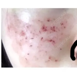 ニューセンス皮膚科クリニック口コミ