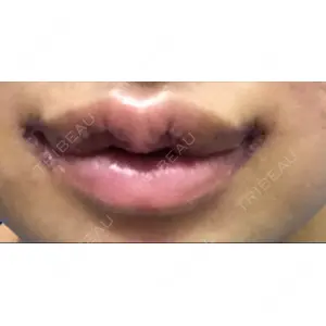 現代美学整形外科口コミ